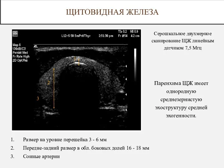 Размер на уровне перешейка 3 - 6 мм Передне-задний размер