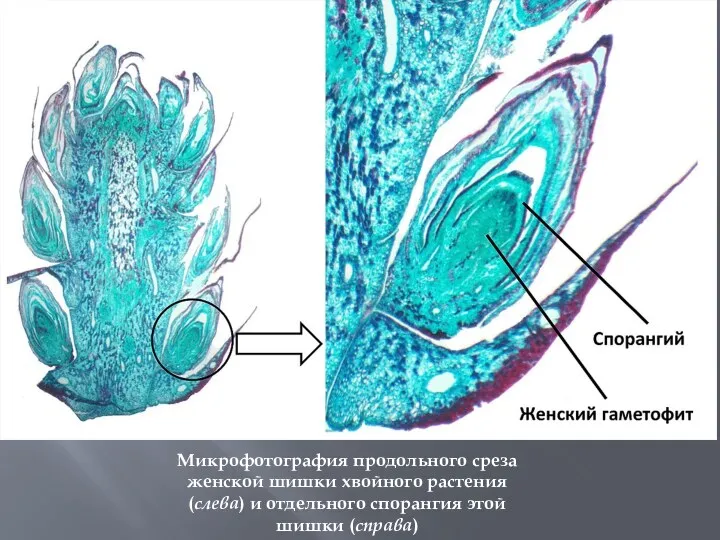 Микрофотография продольного среза женской шишки хвойного растения (слева) и отдельного спорангия этой шишки (справа)