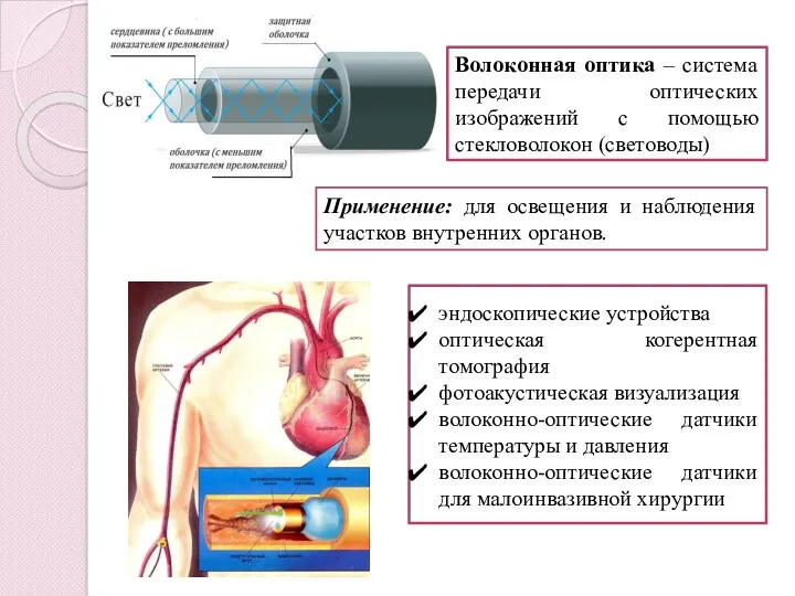 Волоконная оптика – система передачи оптических изображений с помощью стекловолокон (световоды) эндоскопические устройства