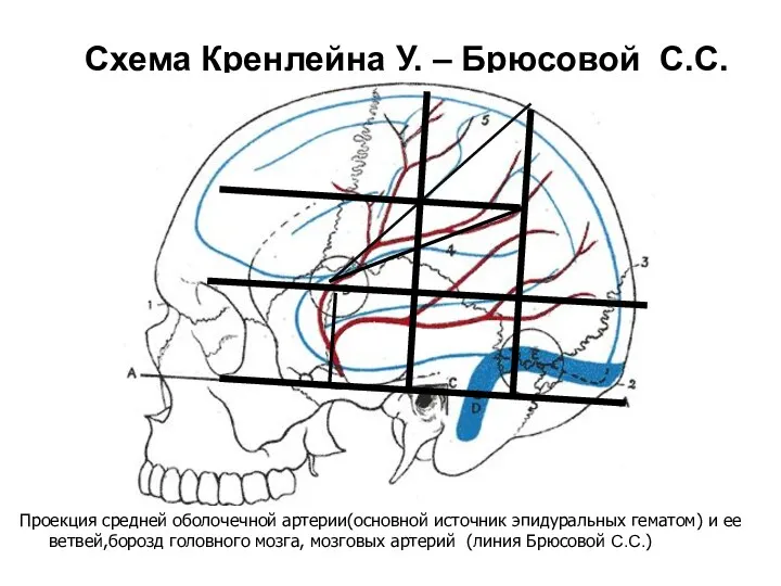 Схема Кренлейна У. – Брюсовой С.С. Проекция средней оболочечной артерии(основной