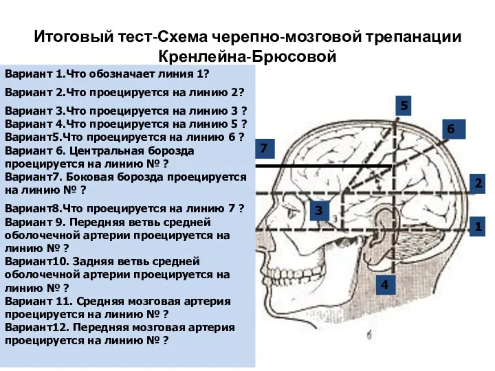 Итоговый тест-Схема черепно-мозговой трепанации Кренлейна-Брюсовой Вариант 1.Что обозначает линия 1?