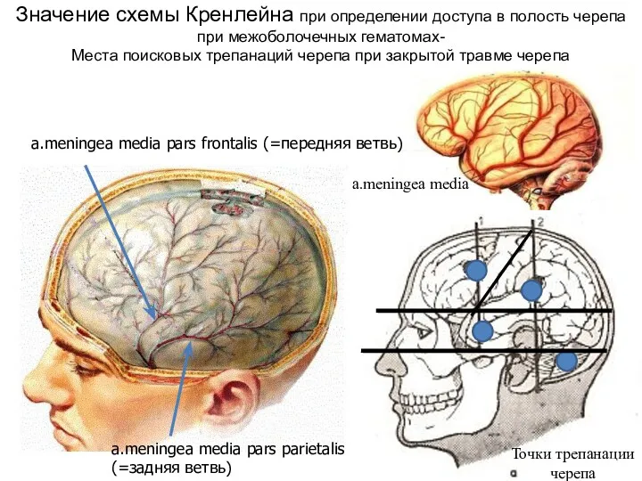 Значение схемы Кренлейна при определении доступа в полость черепа при