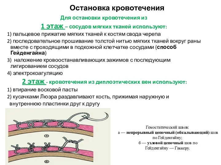 Остановка кровотечения Для остановки кровотечения из 1 этаж – сосудов