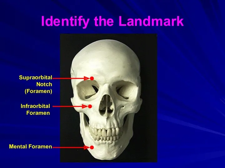 Identify the Landmark Mental Foramen Infraorbital Foramen Supraorbital Notch (Foramen)