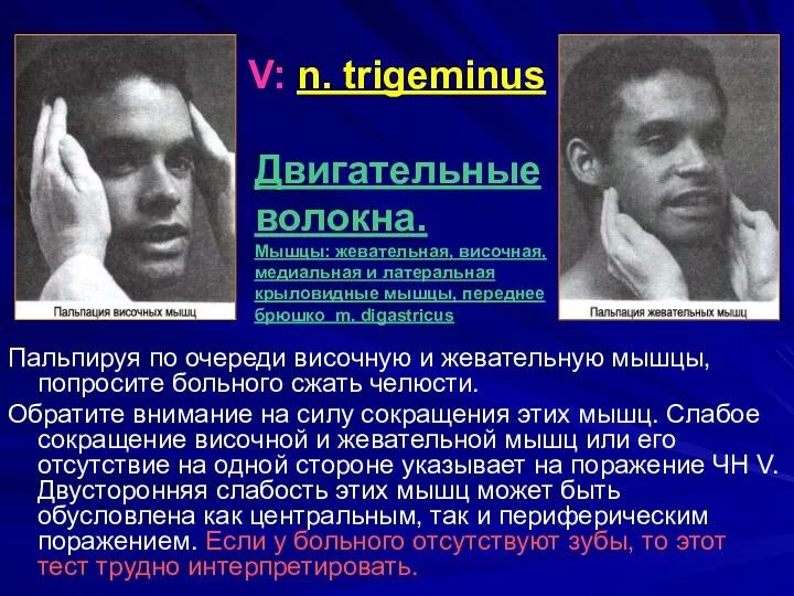 V: n. trigeminus Пальпируя по очереди височную и жевательную мышцы, попросите больного сжать