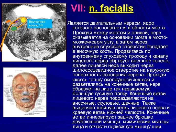 VII: n. facialis Является двигательным нервом, ядро которого располагается в области моста. Проходя