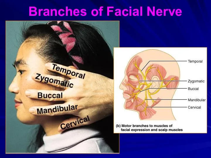Branches of Facial Nerve