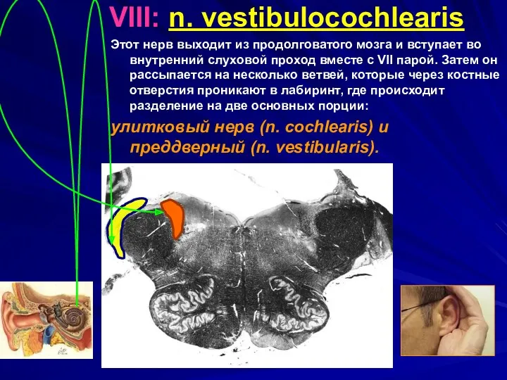 VIII: n. vestibulocochlearis Этот нерв выходит из продолговатого мозга и вступает во внутренний