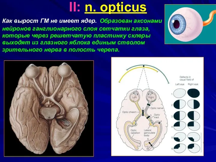 II: n. opticus Как вырост ГМ не имеет ядер. Образован аксонами нейронов ганглионарного
