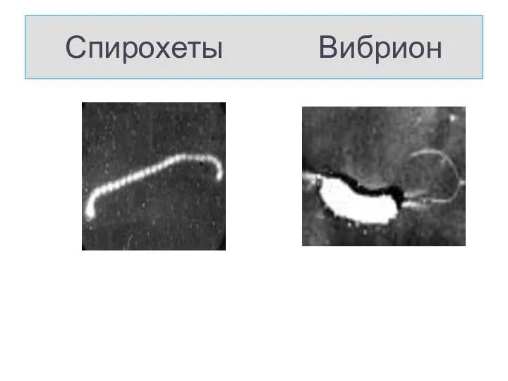 Спирохеты Вибрион