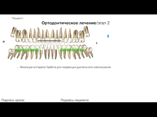 Пациент: Ортодонтическое лечение/этап 2 Подпись врача: Подпись пациента: R L