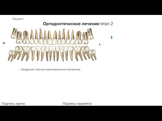 Пациент: Ортодонтическое лечение/этап 2 Подпись врача: Подпись пациента: R L Создание плотных окклюзионных контактов