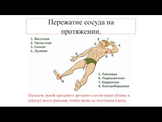 Пережатие сосуда на протяжении. Пальцем, рукой придавить артерию к кости