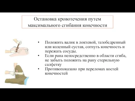 Остановка кровотечения путем максимального сгибания конечности Положить валик в локтевой,