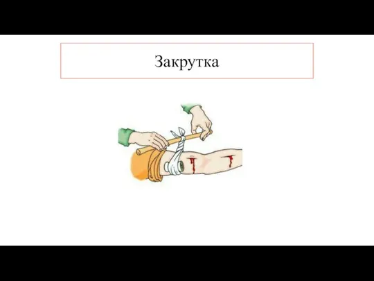 Закрутка