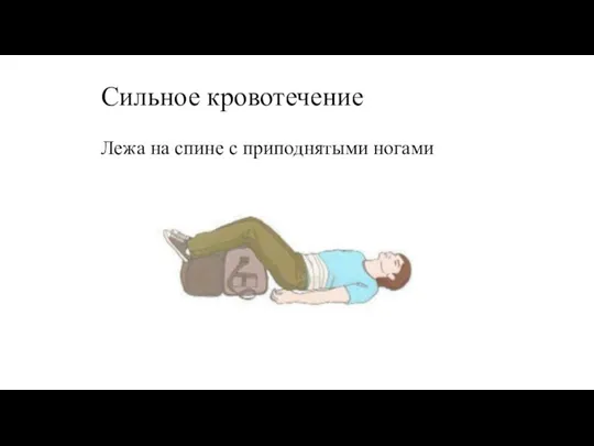 Сильное кровотечение Лежа на спине с приподнятыми ногами