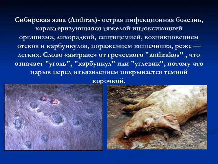 Сибирская язва (Anthrax)- острая инфекционная болезнь, характеризующаяся тяжелой интоксикацией организма,