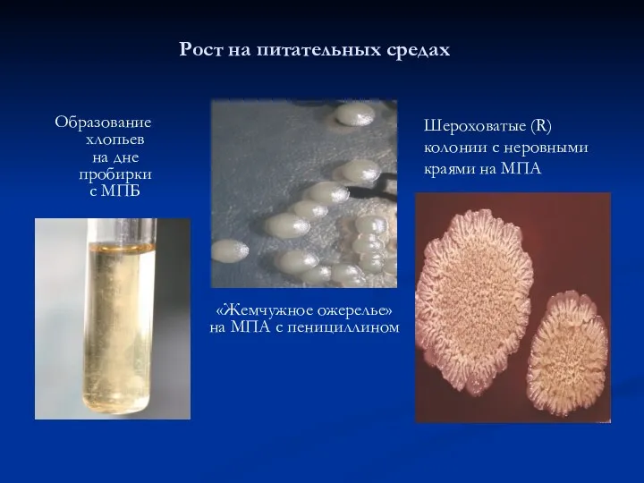 Рост на питательных средах Образование хлопьев на дне пробирки с