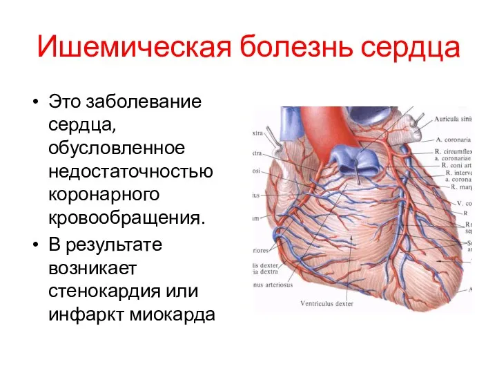 Ишемическая болезнь сердца Это заболевание сердца, обусловленное недостаточностью коронарного кровообращения. В результате возникает