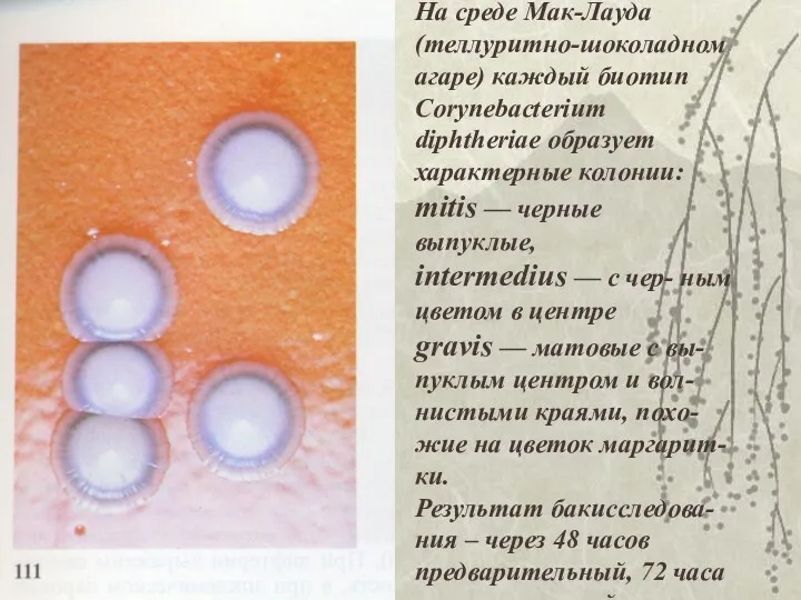 На среде Мак-Лауда (теллуритно-шоколадном агаре) каждый биотип Corynebacterium diphtheriae образует характерные колонии: mitis