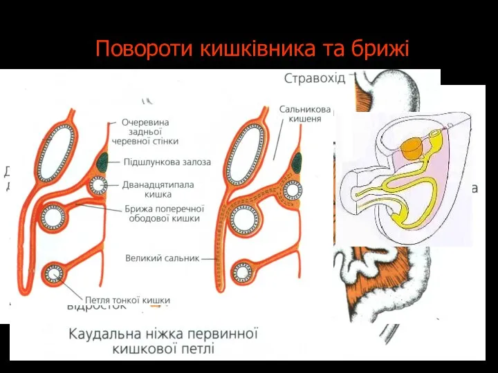 Повороти кишківника та брижі