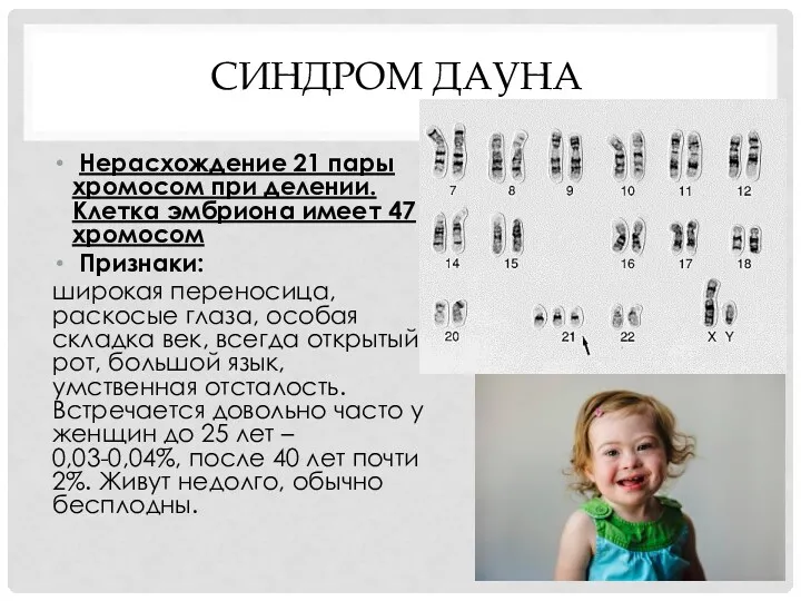 СИНДРОМ ДАУНА Нерасхождение 21 пары хромосом при делении. Клетка эмбриона имеет 47 хромосом