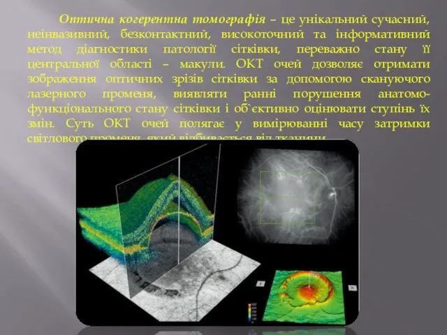 Оптична когерентна томографія – це унікальний сучасний, неінвазивний, безконтактний, високоточний та інформативний метод