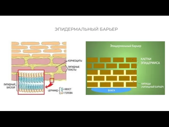 ЭПИДЕРМАЛЬНЫЙ БАРЬЕР