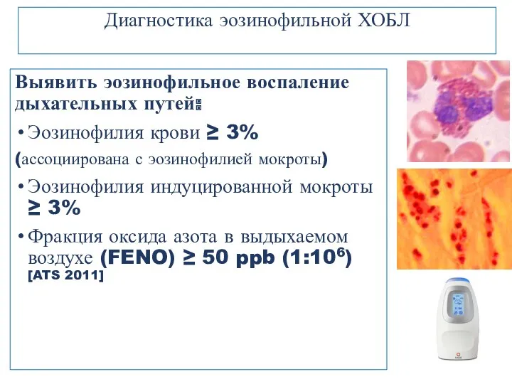 Выявить эозинофильное воспаление дыхательных путей: Эозинофилия крови ≥ 3% (ассоциирована