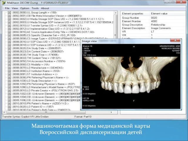 Машиночитаемая форма медицинской карты Всероссийской диспансеризации детей