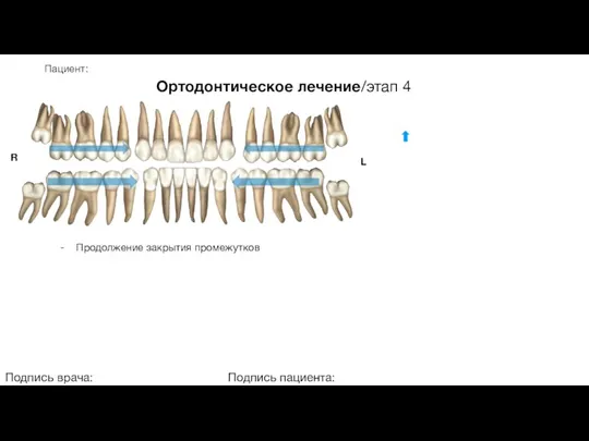 Пациент: Ортодонтическое лечение/этап 4 Подпись врача: Подпись пациента: R L - Продолжение закрытия промежутков