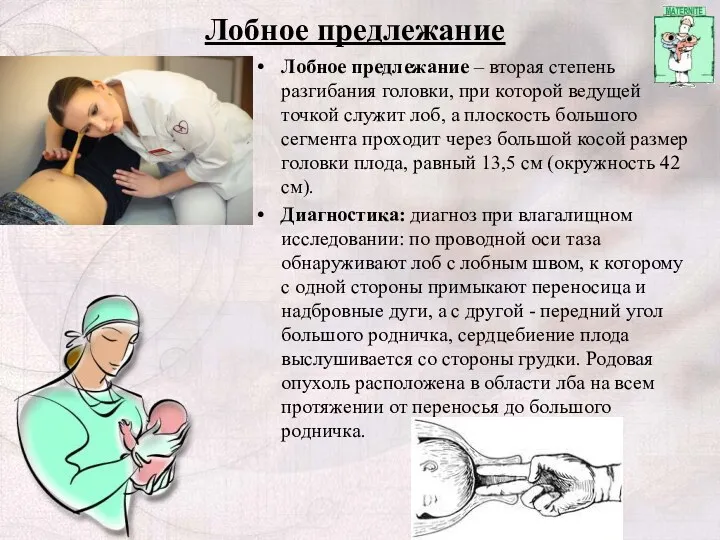 Лобное предлежание Лобное предлежание – вторая степень разгибания головки, при