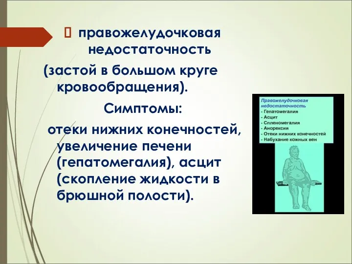 правожелудочковая недостаточность (застой в большом круге кровообращения). Симптомы: отеки нижних