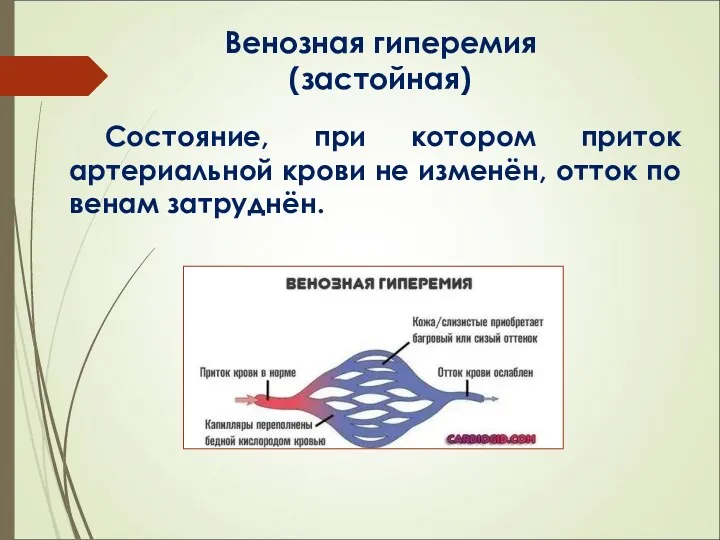 Венозная гиперемия (застойная) Состояние, при котором приток артериальной крови не изменён, отток по венам затруднён.