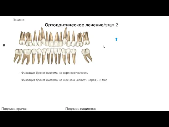 Пациент: Ортодонтическое лечение/этап 2 Подпись врача: Подпись пациента: R L