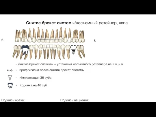 Снятие брекет системы/несъемный ретейнер, капа Подпись врача: Подпись пациента: R