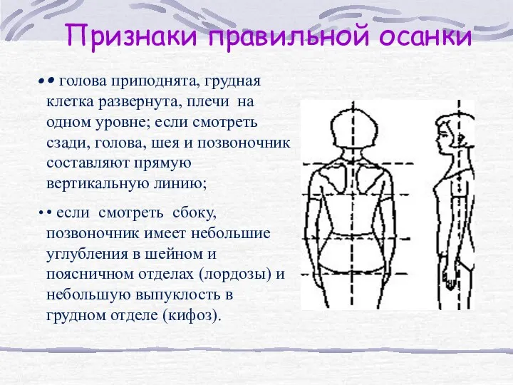 Признаки правильной осанки • голова приподнята, грудная клетка развернута, плечи