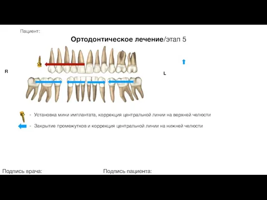 Пациент: Ортодонтическое лечение/этап 5 Подпись врача: Подпись пациента: R L