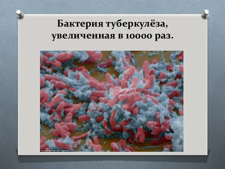 Бактерия туберкулёза, увеличенная в 10000 раз.