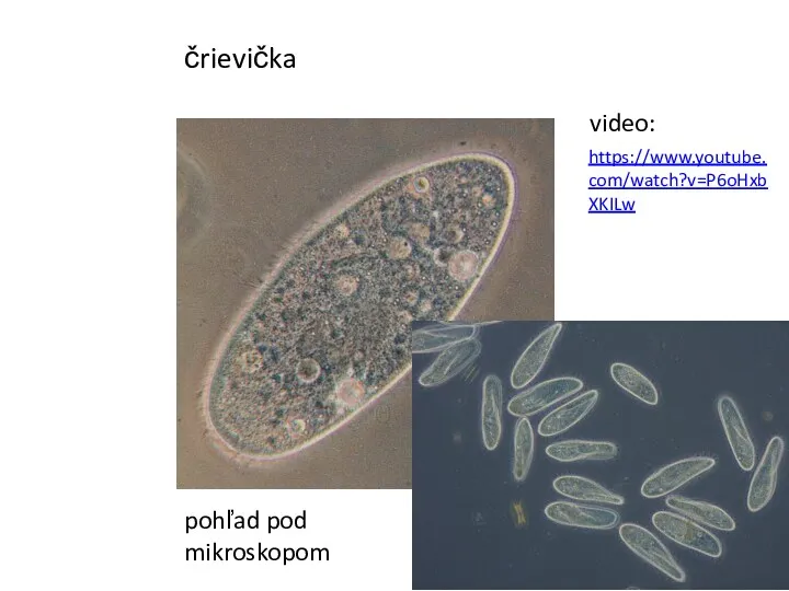 https://www.youtube.com/watch?v=P6oHxbXKILw video: črievička pohľad pod mikroskopom