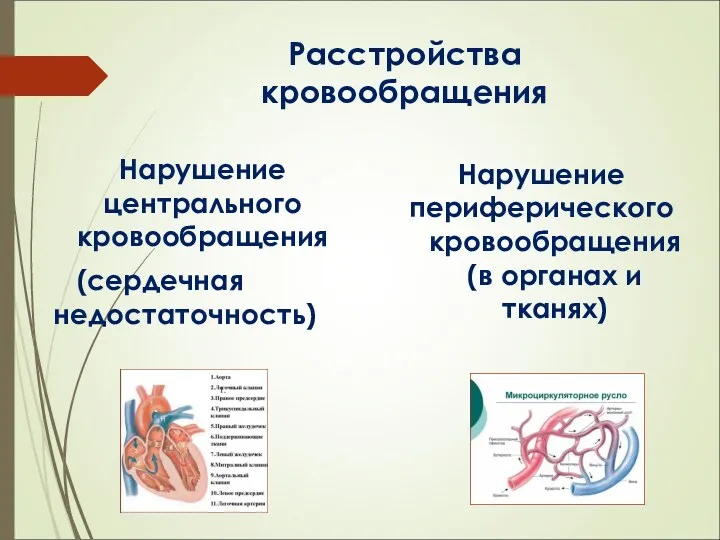 Расстройства кровообращения Нарушение центрального кровообращения (сердечная недостаточность) Нарушение периферического кровообращения (в органах и тканях)