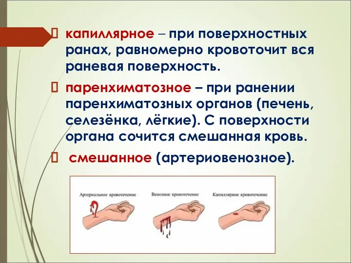 капиллярное – при поверхностных ранах, равномерно кровоточит вся раневая поверхность.