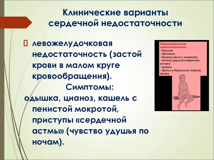 Клинические варианты сердечной недостаточности левожелудочковая недостаточность (застой крови в малом