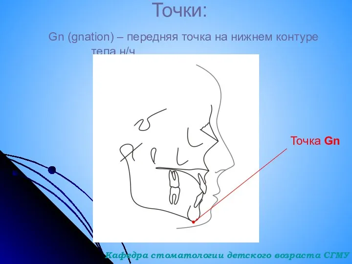 Точки: Gn (gnation) – передняя точка на нижнем контуре тела