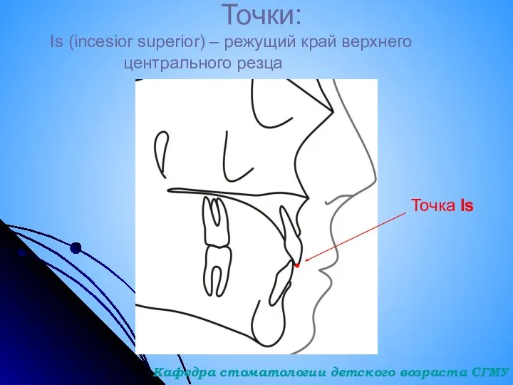 Точки: Is (incesior superior) – режущий край верхнего центрального резца