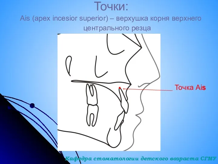 Точки: Ais (apex incesior superior) – верхушка корня верхнего центрального