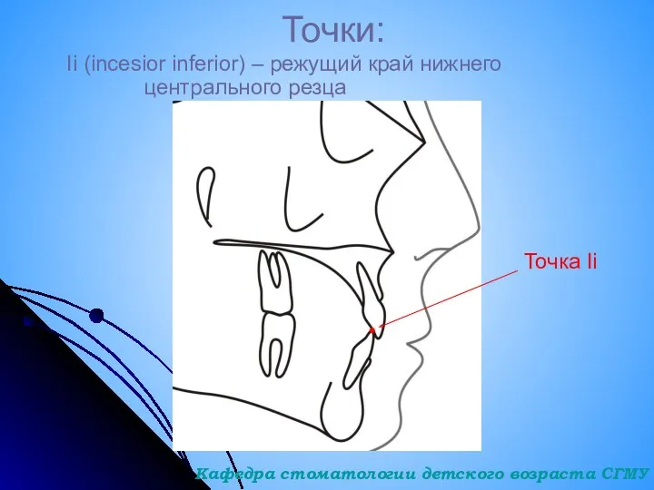 Точки: Ii (incesior inferior) – режущий край нижнего центрального резца