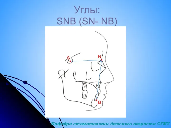 Углы: SNB (SN- NB) S N B Кафедра стоматологии детского возраста СГМУ