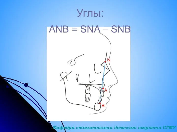 Углы: ANB = SNA – SNB A N B Кафедра стоматологии детского возраста СГМУ