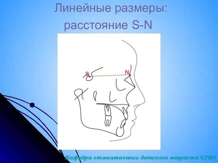 Линейные размеры: S N расстояние S-N Кафедра стоматологии детского возраста СГМУ